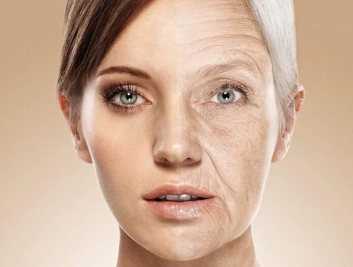 pel facial antes e despois do rexuvenecemento con láser
